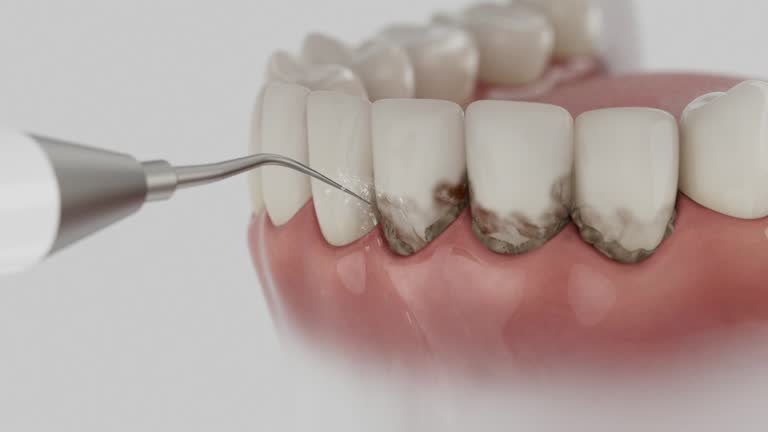 Reliable Dental Implants contractor in Lenwood, CA by Smile Center Dentistry